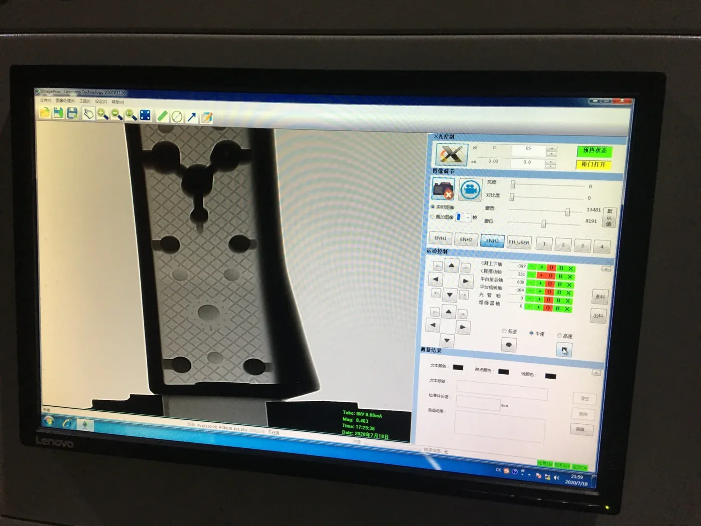 X-ray screening result for the cast aluminum component
